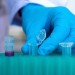 Diagnostics